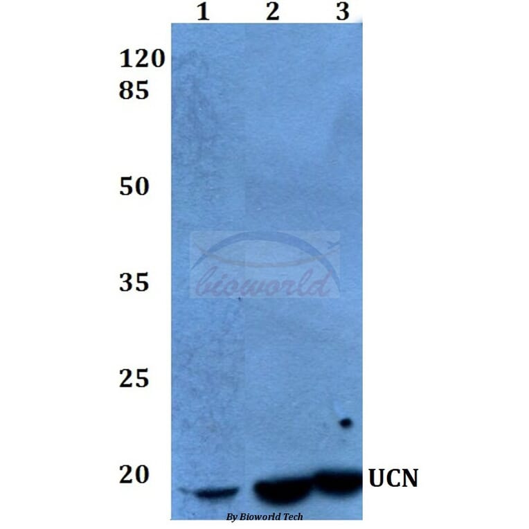 Anti-UCN (A103) Antibody from Bioworld Technology (BS1488) - Antibodies.com