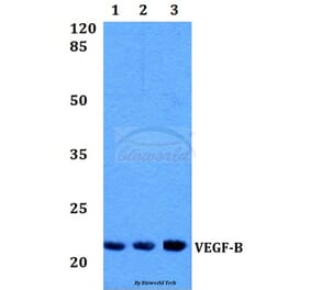 Anti-VEGFB (R125) Antibody from Bioworld Technology (BS1490) - Antibodies.com