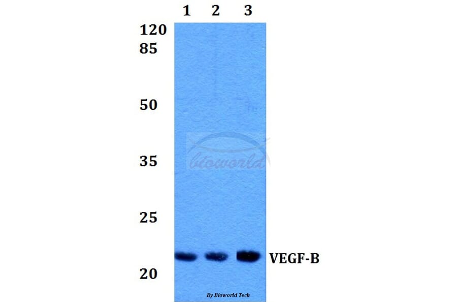 Anti-VEGFB (R125) Antibody from Bioworld Technology (BS1490) - Antibodies.com