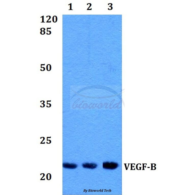 Anti-VEGFB (R125) Antibody from Bioworld Technology (BS1490) - Antibodies.com