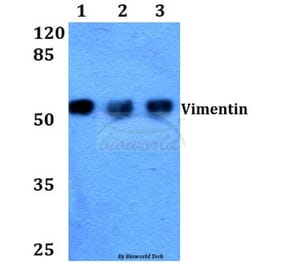 Anti-Vimentin (I444) Antibody from Bioworld Technology (BS1491) - Antibodies.com