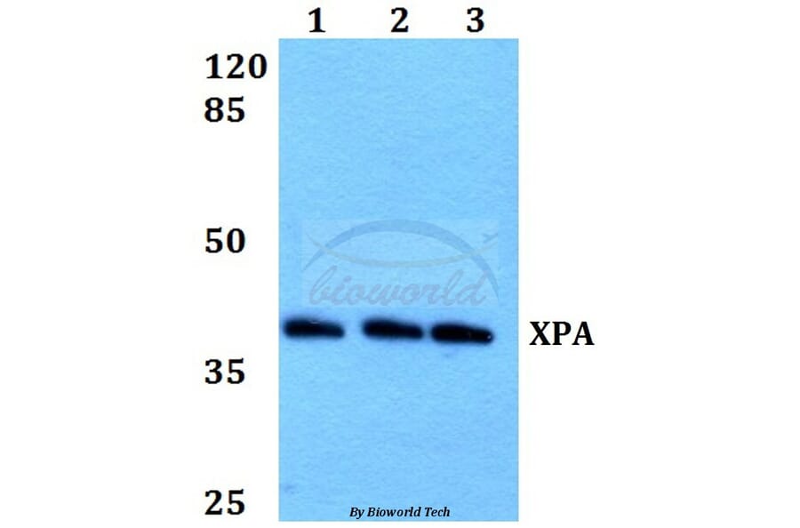 Anti-XPA (H244) Antibody from Bioworld Technology (BS1492) - Antibodies.com