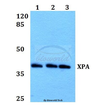 Anti-XPA (H244) Antibody from Bioworld Technology (BS1492) - Antibodies.com