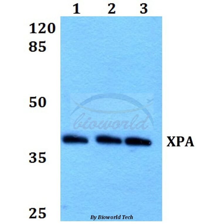 Anti-XPA (H244) Antibody from Bioworld Technology (BS1492) - Antibodies.com
