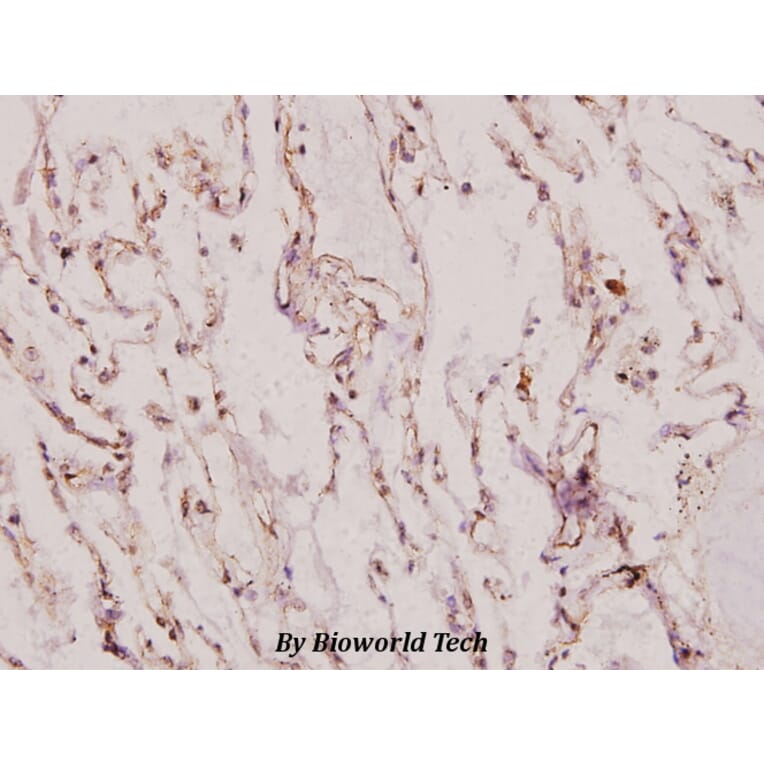Anti-XRCC1 (G552) Antibody from Bioworld Technology (BS1493) - Antibodies.com