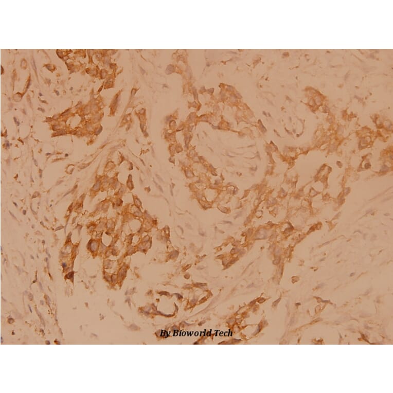 Anti-Ku-70 (R586) Antibody from Bioworld Technology (BS1498) - Antibodies.com