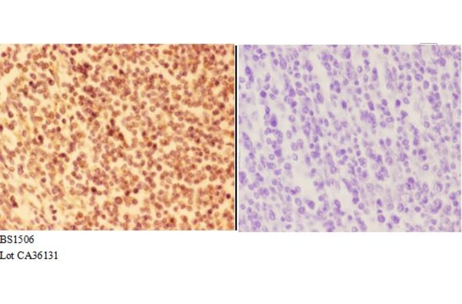 Anti-ALOX5 (E267) Antibody from Bioworld Technology (BS1506) - Antibodies.com