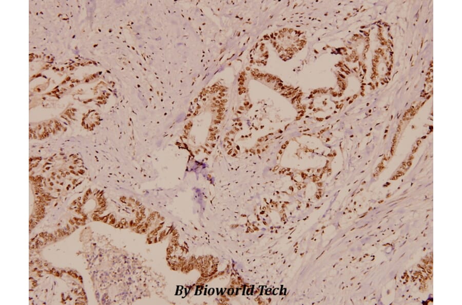 Anti-APC (K2050) Antibody from Bioworld Technology (BS1507) - Antibodies.com