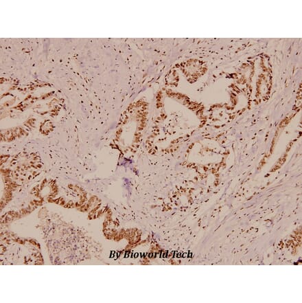 Anti-APC (K2050) Antibody from Bioworld Technology (BS1507) - Antibodies.com