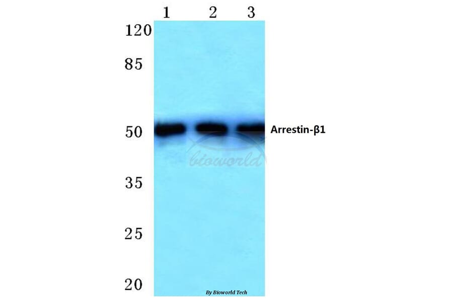 Anti-Arrestin-β-1 (E406) Antibody from Bioworld Technology (BS1509) - Antibodies.com