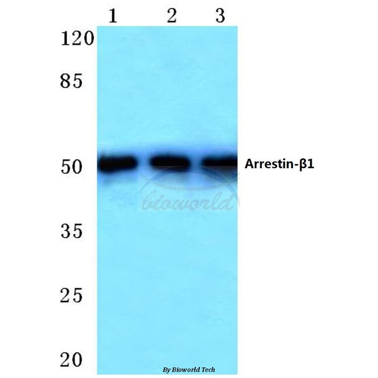 Anti-Arrestin-β-1 (E406) Antibody from Bioworld Technology (BS1509) - Antibodies.com