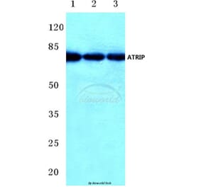 Anti-ATRIP (D64) Antibody from Bioworld Technology (BS1510) - Antibodies.com