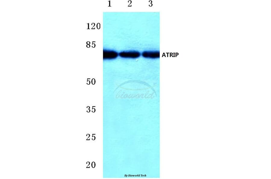 Anti-ATRIP (D64) Antibody from Bioworld Technology (BS1510) - Antibodies.com