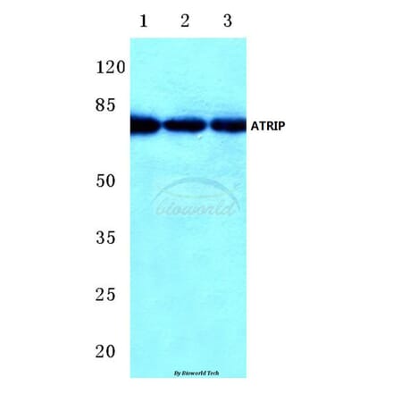 Anti-ATRIP (D64) Antibody from Bioworld Technology (BS1510) - Antibodies.com