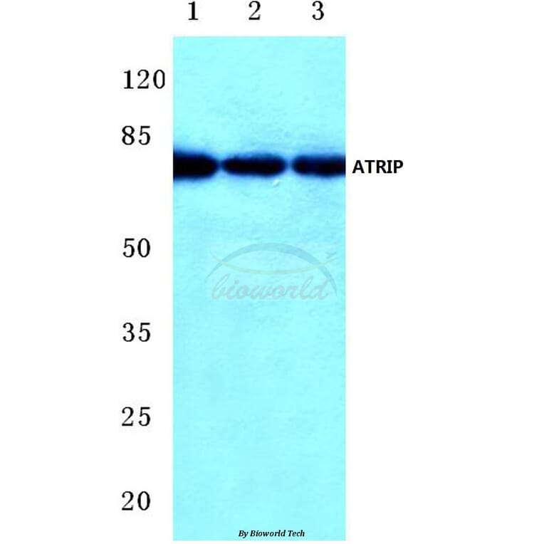 Anti-ATRIP (D64) Antibody from Bioworld Technology (BS1510) - Antibodies.com