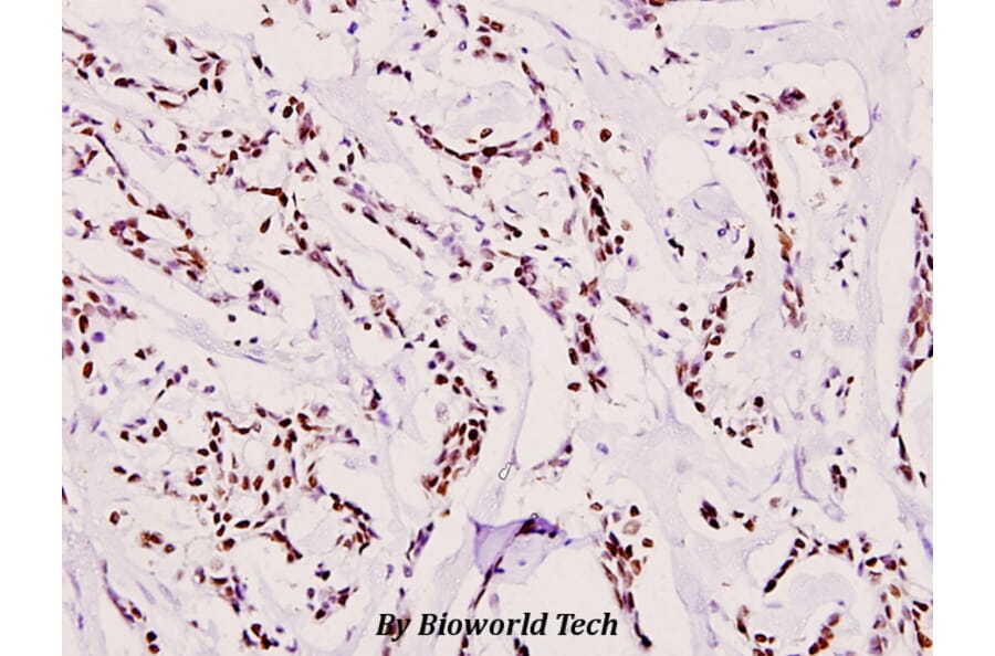 Anti-ATRIP (D64) Antibody from Bioworld Technology (BS1510) - Antibodies.com