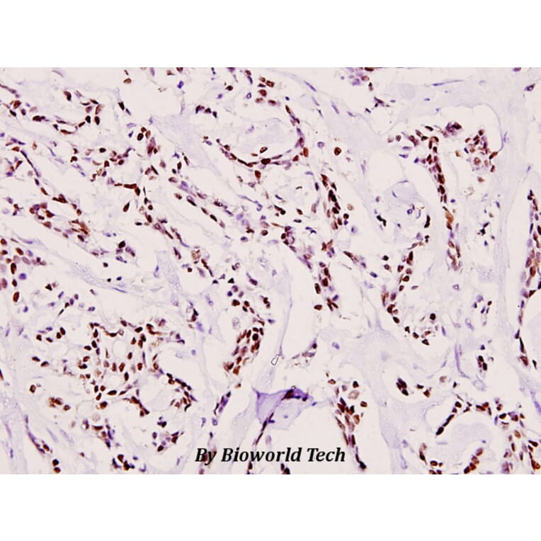 Anti-ATRIP (D64) Antibody from Bioworld Technology (BS1510) - Antibodies.com