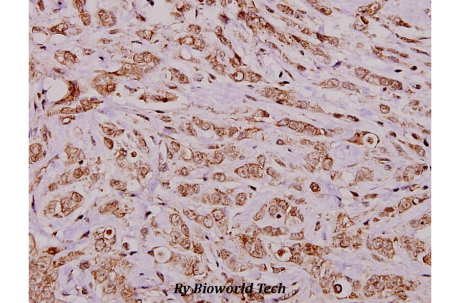 Anti-Bcl-2 (P65) Antibody from Bioworld Technology (BS1511) - Antibodies.com