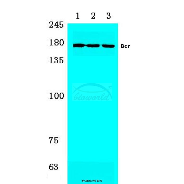 Anti-Bcr (S356) Antibody from Bioworld Technology (BS1513) - Antibodies.com