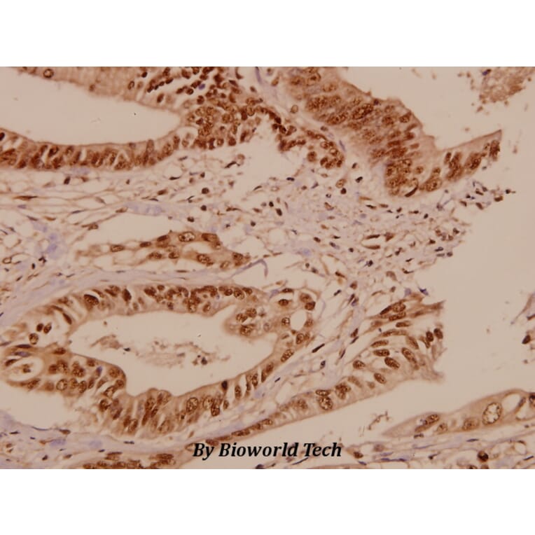 Anti-Bcr (S356) Antibody from Bioworld Technology (BS1513) - Antibodies.com