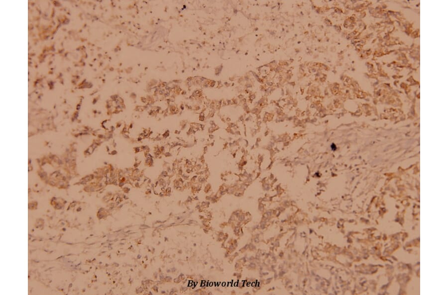 Anti-Raf-B (A597) Antibody from Bioworld Technology (BS1514) - Antibodies.com