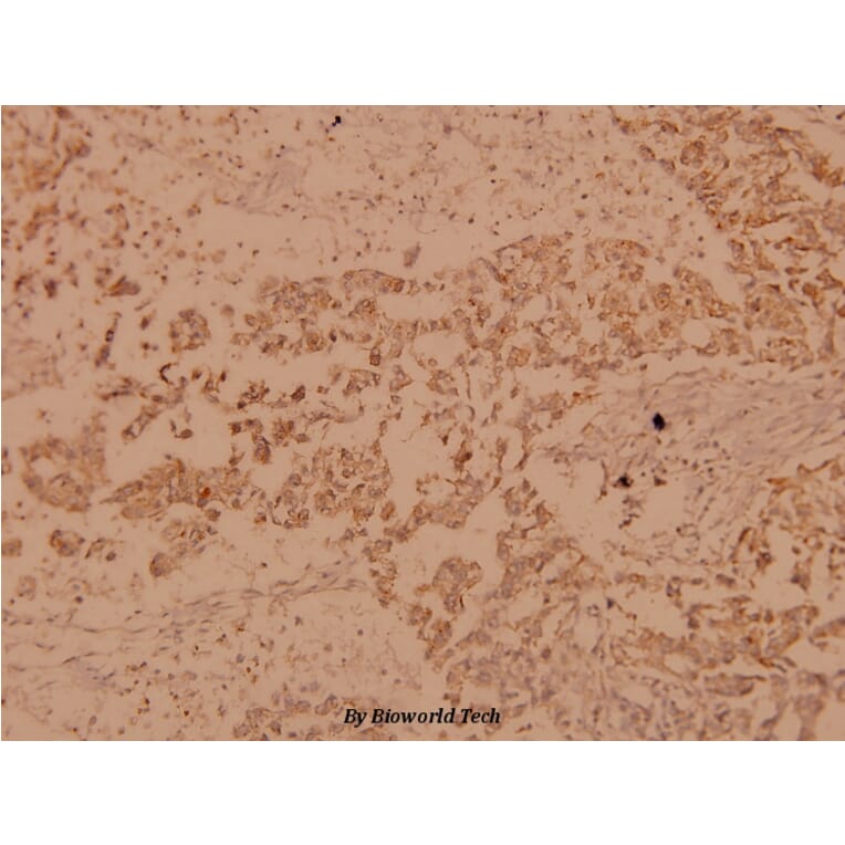 Anti-Raf-B (A597) Antibody from Bioworld Technology (BS1514) - Antibodies.com