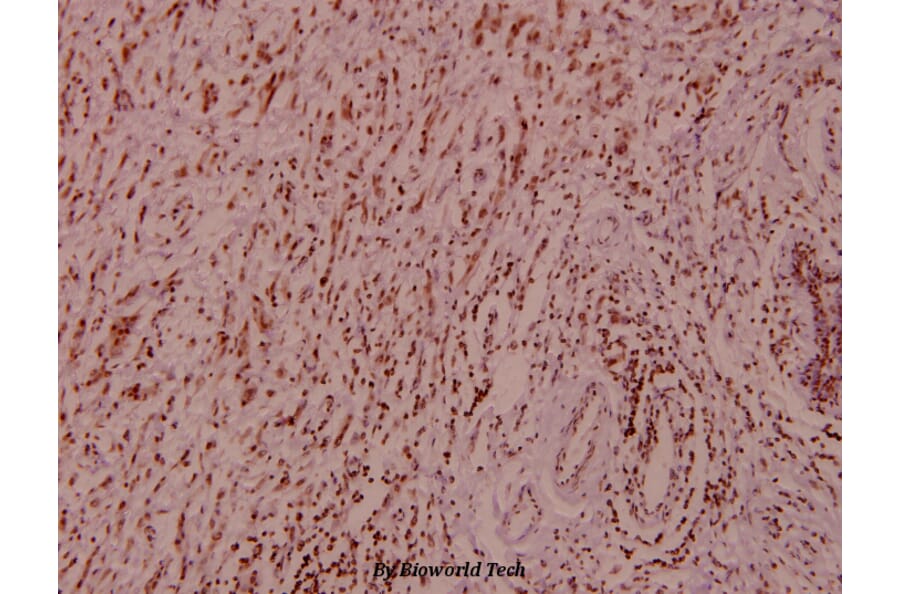 Anti-Raf-B (F594) Antibody from Bioworld Technology (BS1515) - Antibodies.com