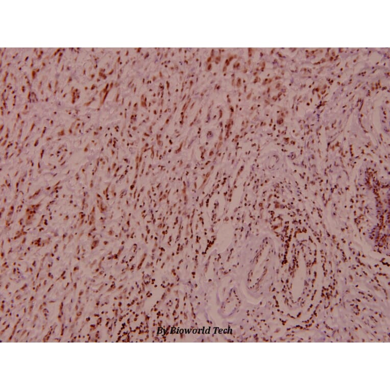 Anti-Raf-B (F594) Antibody from Bioworld Technology (BS1515) - Antibodies.com