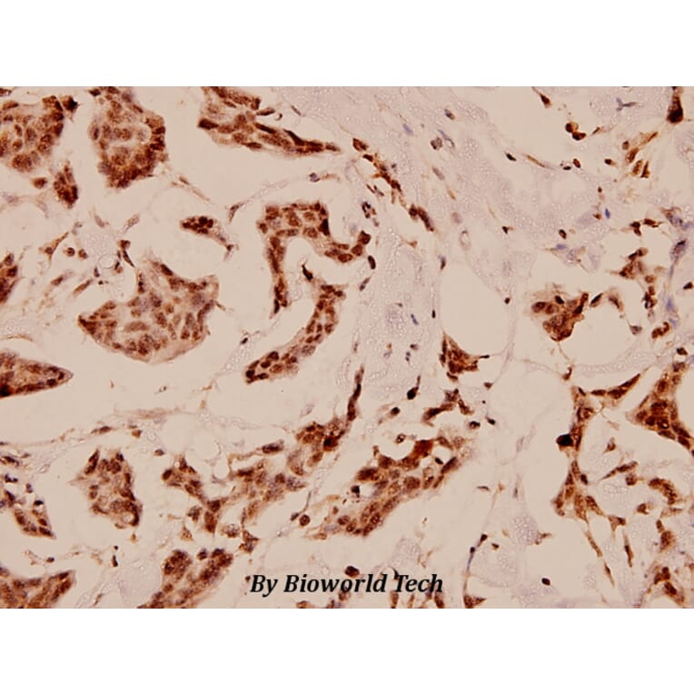 Anti-C/EBP-ε (K70) Antibody from Bioworld Technology (BS1516) - Antibodies.com