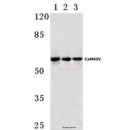 Anti-CaMKIV (V192) Antibody from Bioworld Technology (BS1517) - Antibodies.com