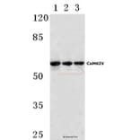 Anti-CaMKIV (V192) Antibody from Bioworld Technology (BS1517) - Antibodies.com
