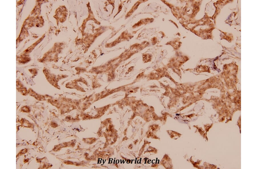 Anti-CaMKIV (V192) Antibody from Bioworld Technology (BS1517) - Antibodies.com