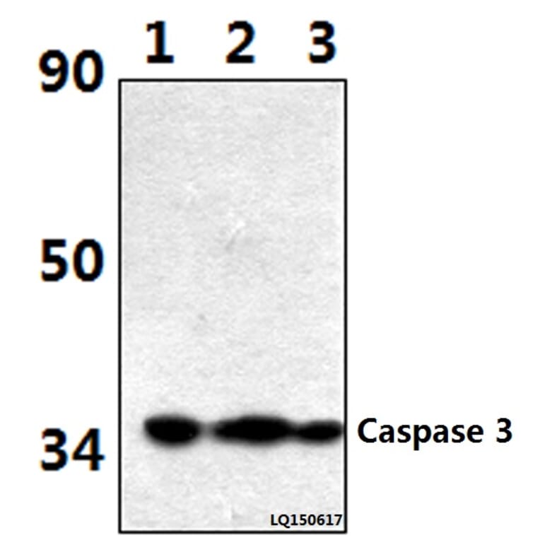 Anti-Caspase 3 (D146) Antibody from Bioworld Technology (BS1518) - Antibodies.com