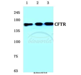 Anti-CFTR (E733) Antibody from Bioworld Technology (BS1525) - Antibodies.com