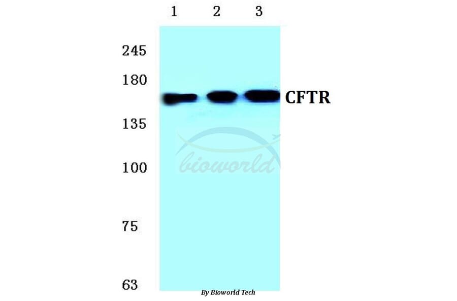 Anti-CFTR (E733) Antibody from Bioworld Technology (BS1525) - Antibodies.com