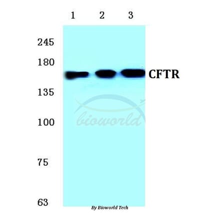 Anti-CFTR (E733) Antibody from Bioworld Technology (BS1525) - Antibodies.com