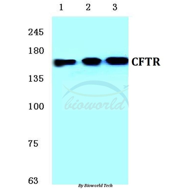 Anti-CFTR (E733) Antibody from Bioworld Technology (BS1525) - Antibodies.com