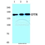 Anti-CFTR (E733) Antibody from Bioworld Technology (BS1525) - Antibodies.com