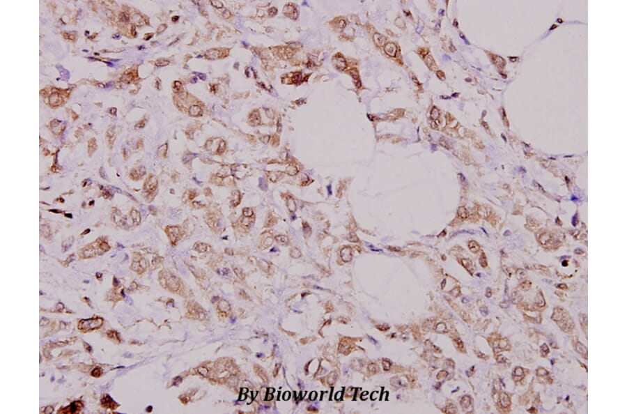 Anti-CFTR (E733) Antibody from Bioworld Technology (BS1525) - Antibodies.com