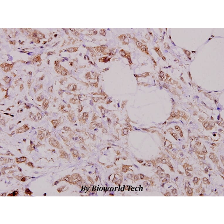 Anti-CFTR (E733) Antibody from Bioworld Technology (BS1525) - Antibodies.com