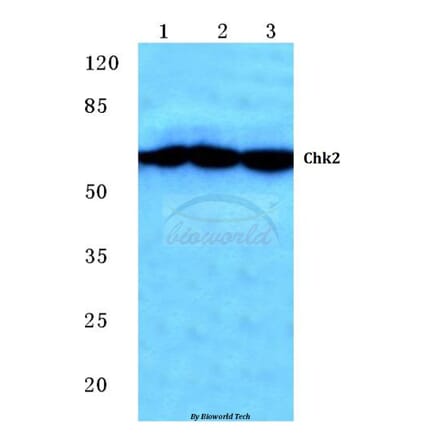 Anti-Chk2 (S379) Antibody from Bioworld Technology (BS1526) - Antibodies.com