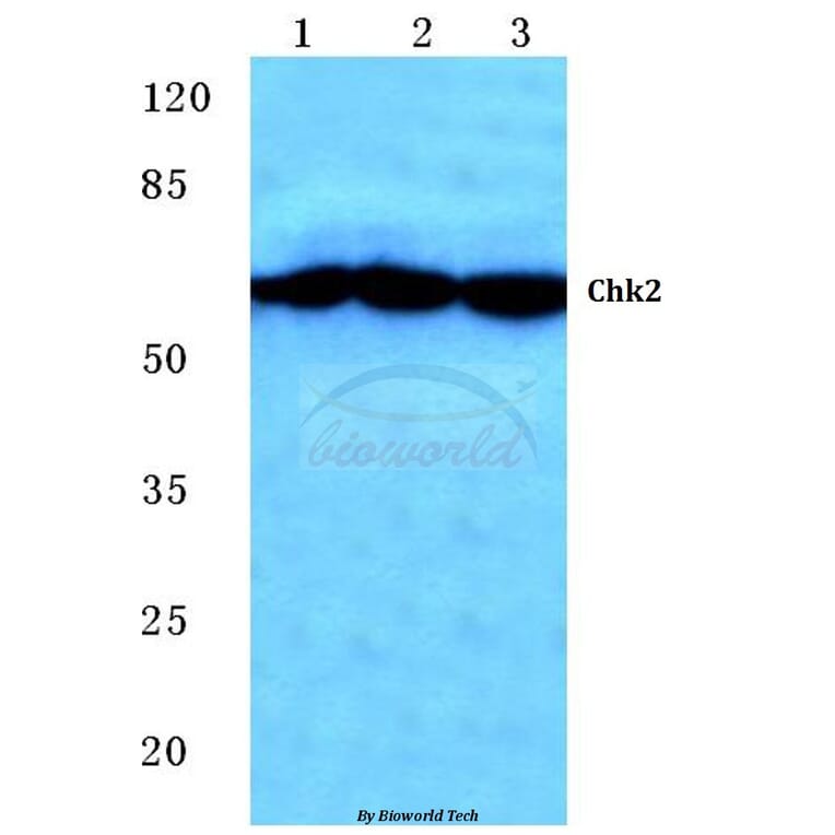 Anti-Chk2 (S379) Antibody from Bioworld Technology (BS1526) - Antibodies.com