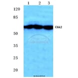 Anti-Chk2 (S379) Antibody from Bioworld Technology (BS1526) - Antibodies.com