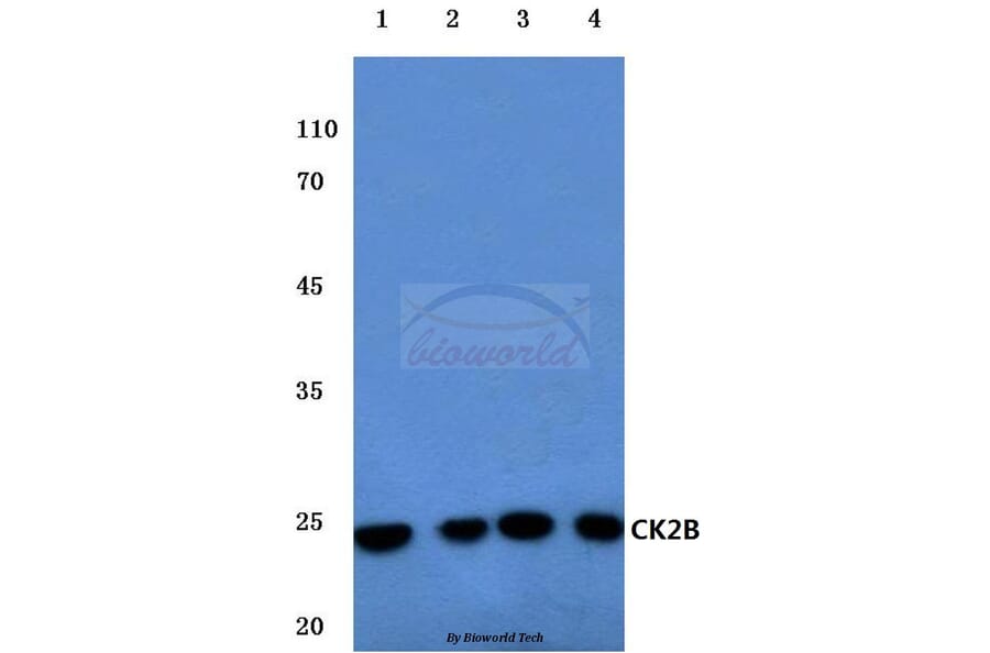 Anti-Casein Kinase IIβ (S205) Antibody from Bioworld Technology (BS1529) - Antibodies.com