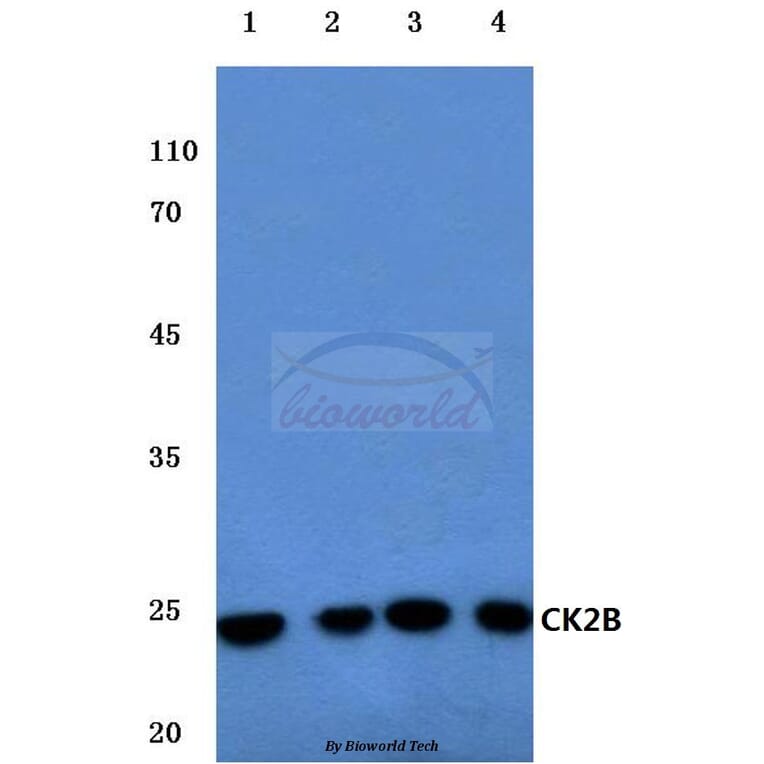 Anti-Casein Kinase IIβ (S205) Antibody from Bioworld Technology (BS1529) - Antibodies.com