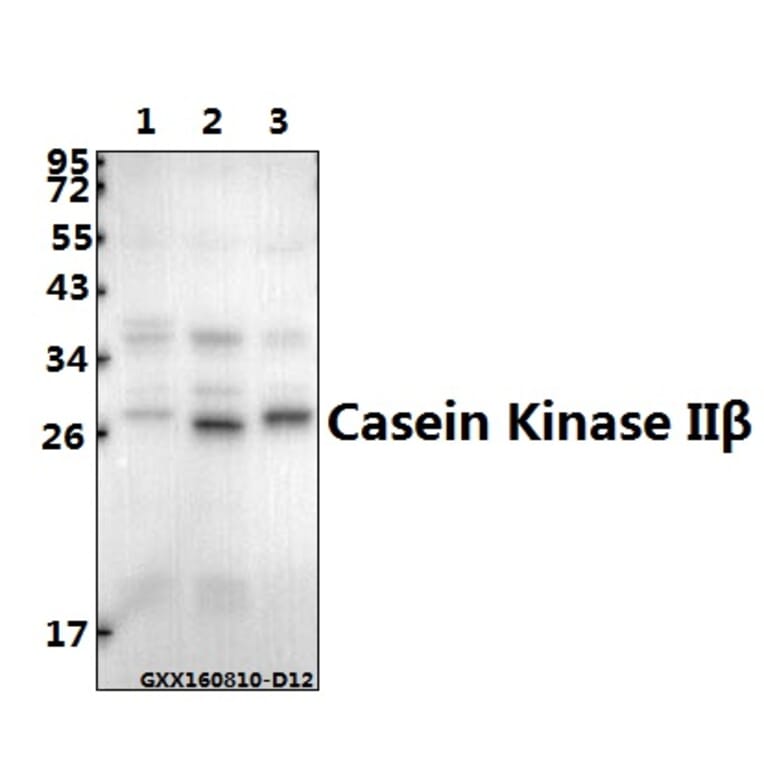 Anti-Casein Kinase IIβ (S205) Antibody from Bioworld Technology (BS1529) - Antibodies.com