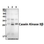 Anti-Casein Kinase IIβ (S205) Antibody from Bioworld Technology (BS1529) - Antibodies.com