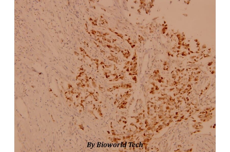 Anti-Casein Kinase IIβ (S205) Antibody from Bioworld Technology (BS1529) - Antibodies.com