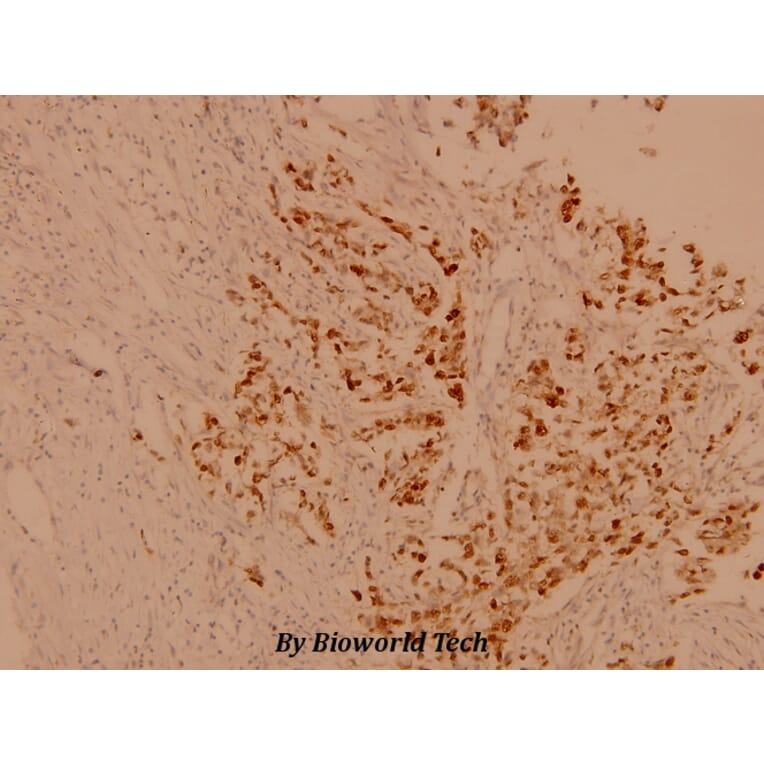 Anti-Casein Kinase IIβ (S205) Antibody from Bioworld Technology (BS1529) - Antibodies.com