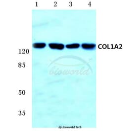 Anti-COL1A2 (S3) Antibody from Bioworld Technology (BS1530) - Antibodies.com
